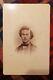 1860s Civil War Soldier. Rare Cabinet Card. Couragious Hero
