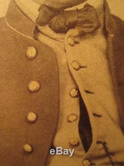 Antique CIVIL War Union Soldier Buttons Kepi #3 Large Rare Photo Last Found Ma