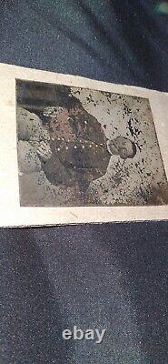 Antique Civil War UNION SOLDIER Tintype Photograph Face Looks Injured & Bandaged