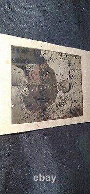 Antique Civil War UNION SOLDIER Tintype Photograph Face Looks Injured & Bandaged