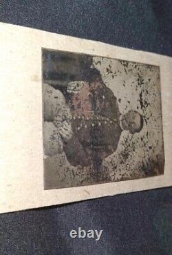 Antique Civil War UNION SOLDIER Tintype Photograph Face Looks Injured & Bandaged