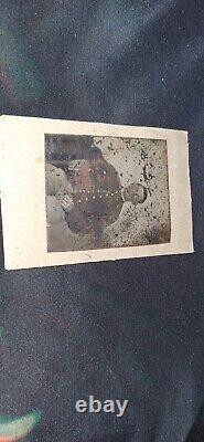 Antique Civil War UNION SOLDIER Tintype Photograph Face Looks Injured & Bandaged