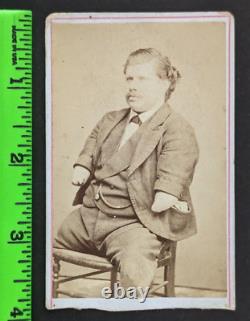 Antique Civil War Vet Man ID'd Arm Leg Quadruple Amputee Bowery NY Photo CDV