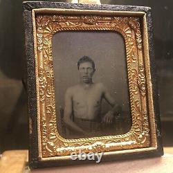 Believed To Be Wounded CIVIL War Soldier Tintype Photograph Face Shirtless Union