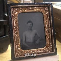 Believed To Be Wounded CIVIL War Soldier Tintype Photograph Face Shirtless Union