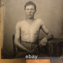 Believed To Be Wounded CIVIL War Soldier Tintype Photograph Face Shirtless Union