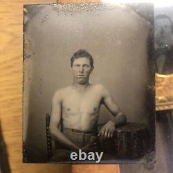 Believed To Be Wounded CIVIL War Soldier Tintype Photograph Face Shirtless Union