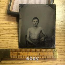 Believed To Be Wounded CIVIL War Soldier Tintype Photograph Face Shirtless Union