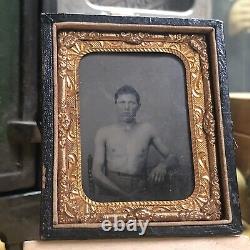Believed To Be Wounded CIVIL War Soldier Tintype Photograph Face Shirtless Union