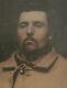 Civil War Ambrotype. Soldier In Uniform. Tinted 6th Plate, Full Case