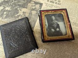 Civil War Photograph Tin Type Soldier Sack Coat Amputation Amputee