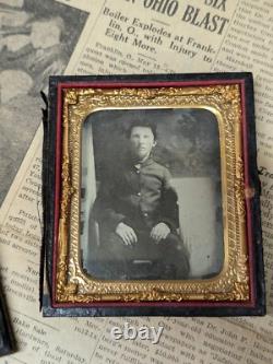 Civil War Photograph Tin Type Soldier Sack Coat Amputation Amputee
