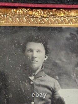 Civil War Photograph Tin Type Soldier Sack Coat Amputation Amputee