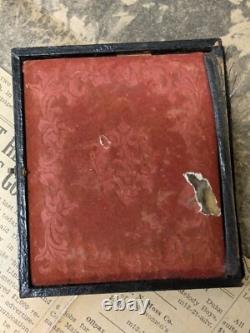 Civil War Photograph Tin Type Soldier Sack Coat Amputation Amputee