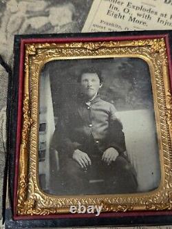 Civil War Photograph Tin Type Soldier Sack Coat Amputation Amputee