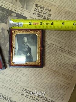 Civil War Photograph Tin Type Soldier Sack Coat Amputation Amputee