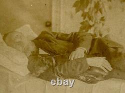 Exceedingly rare civil war era post mortem Carte de visite Man and Dog in bed