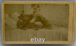 Exceedingly rare civil war era post mortem Carte de visite Man and Dog in bed