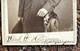 Id'd Civil War Surgeon 58th Indiana Infantry Samuel E. Holtzman Signed Cdv Photo