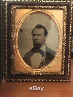 Identified Civil War Soldier Ambrotype WIA 31st Maine Infantry