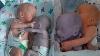 Nurse Put The Healthy Baby Next To Her Dying Twin And A Real Miracle Happened