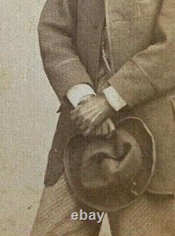 ORIGINAL CIVIL WAR ERA YOUNG MAN with PROSTHETIC HAND CDV PHOTO FREDRICKS NY 1862