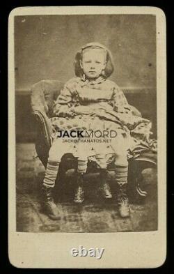 Rare / Unusual Photo 4-Legged Girl with Parasitic Twin / Sideshow Freak Show