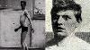 Unsettling Ww1 Horrific Injury And Wound Photos You Re Not Allowed To See