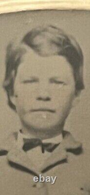X RARE 1800s CIVIL WAR ERA TINTYPE of DECEASED BOY PROPED UP STANDING with BRACE